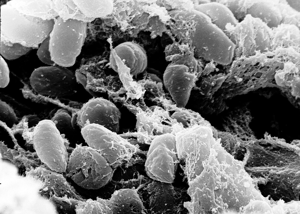 Bactérias da peste, em formato de bastão, vistas em microscópio eletrônico em preto e branco
